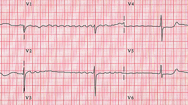 cardiology img